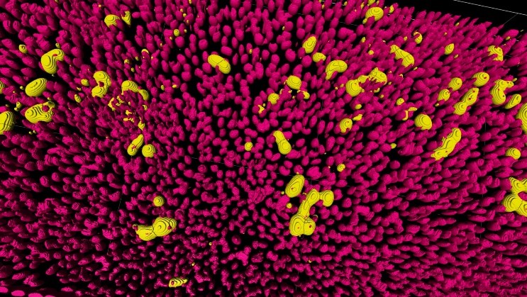 In the accompanying image, cell nuclei appear in pink, while yellow highlights cells infected with MERS